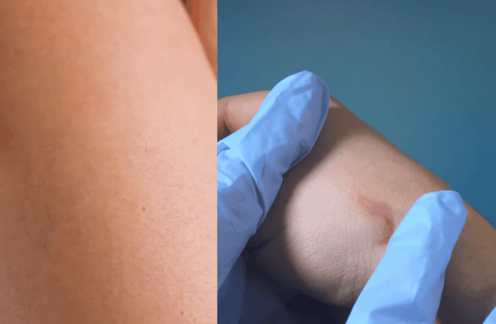 Pain Management and Aftercare Tips